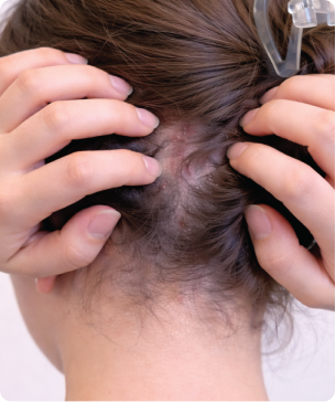 Helps support a refreshed scalp environment and better hair health.